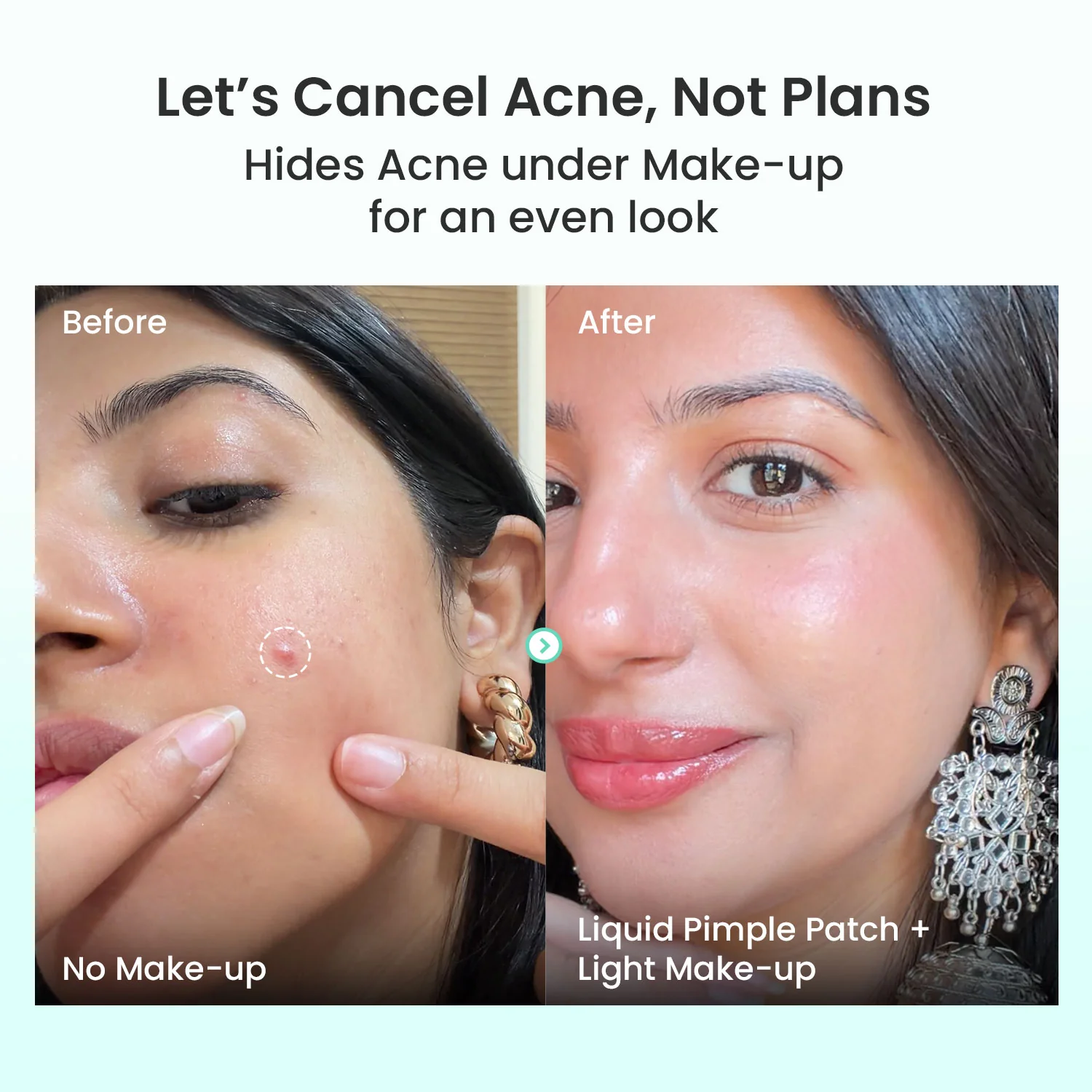 Liquid Pimple Patch - Image 3