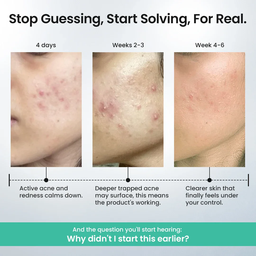 Rapid Clear Facewash - Image 5