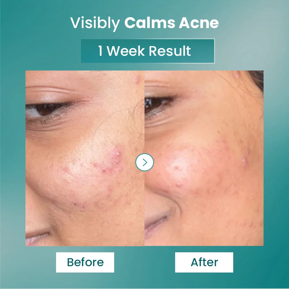 Spot Fade Advanced Repair Serum - Image 4